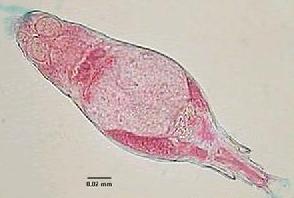 (图)水处理微生物照片 (图)水处理微生物照片